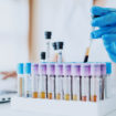Digital transformation: Bayer prescribes a different approach