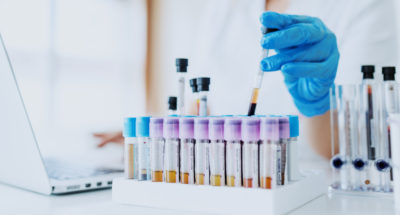 Digital transformation: Bayer prescribes a different approach