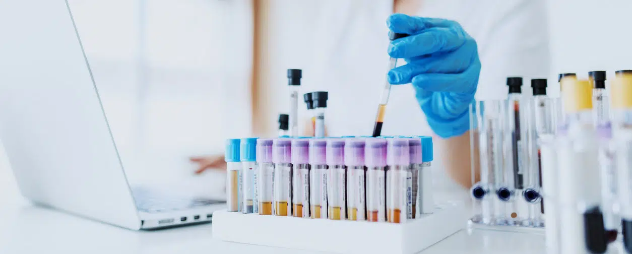 Digital transformation: Bayer prescribes a different approach