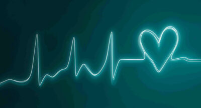 NEW Mainarticle_EKG_MidjourneyV_paulandcat